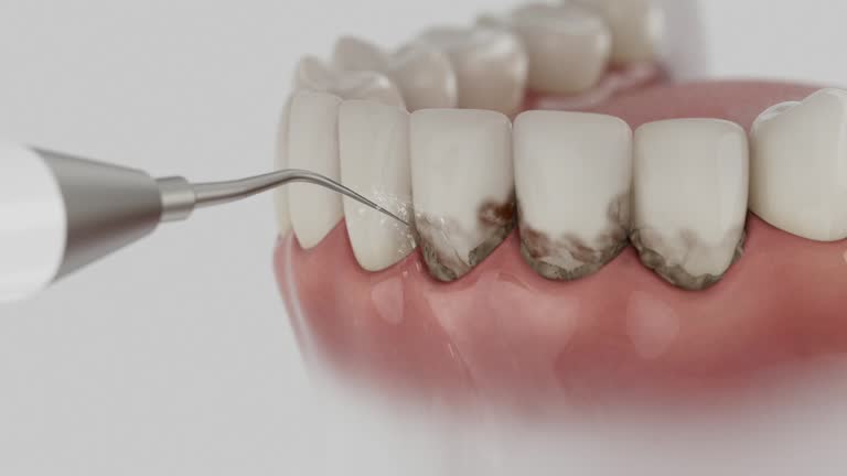 Reliable Dental contractor in Carpinteria, CA by Smile Center Dentistry
